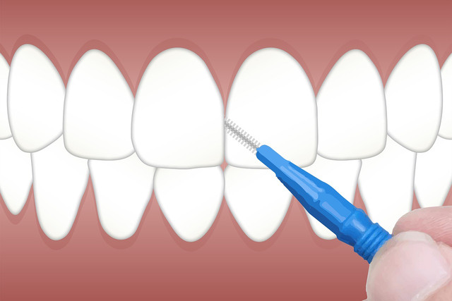 Jak czyścić protezy zębowe za pomocą octu